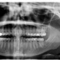 Dental Exam and X-rays: What You Need to Know