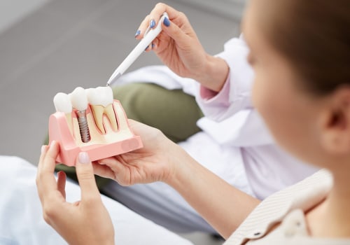 How Dental Discount Plans Can Save You Money on Implants