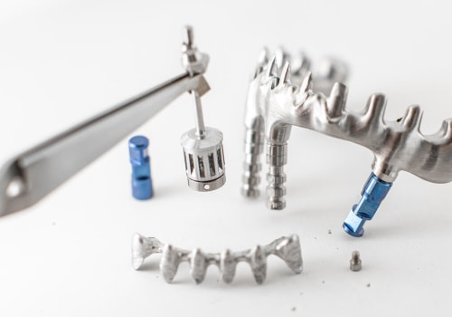 All About Subperiosteal Implants: A Guide to Understanding This Type of Dental Implant